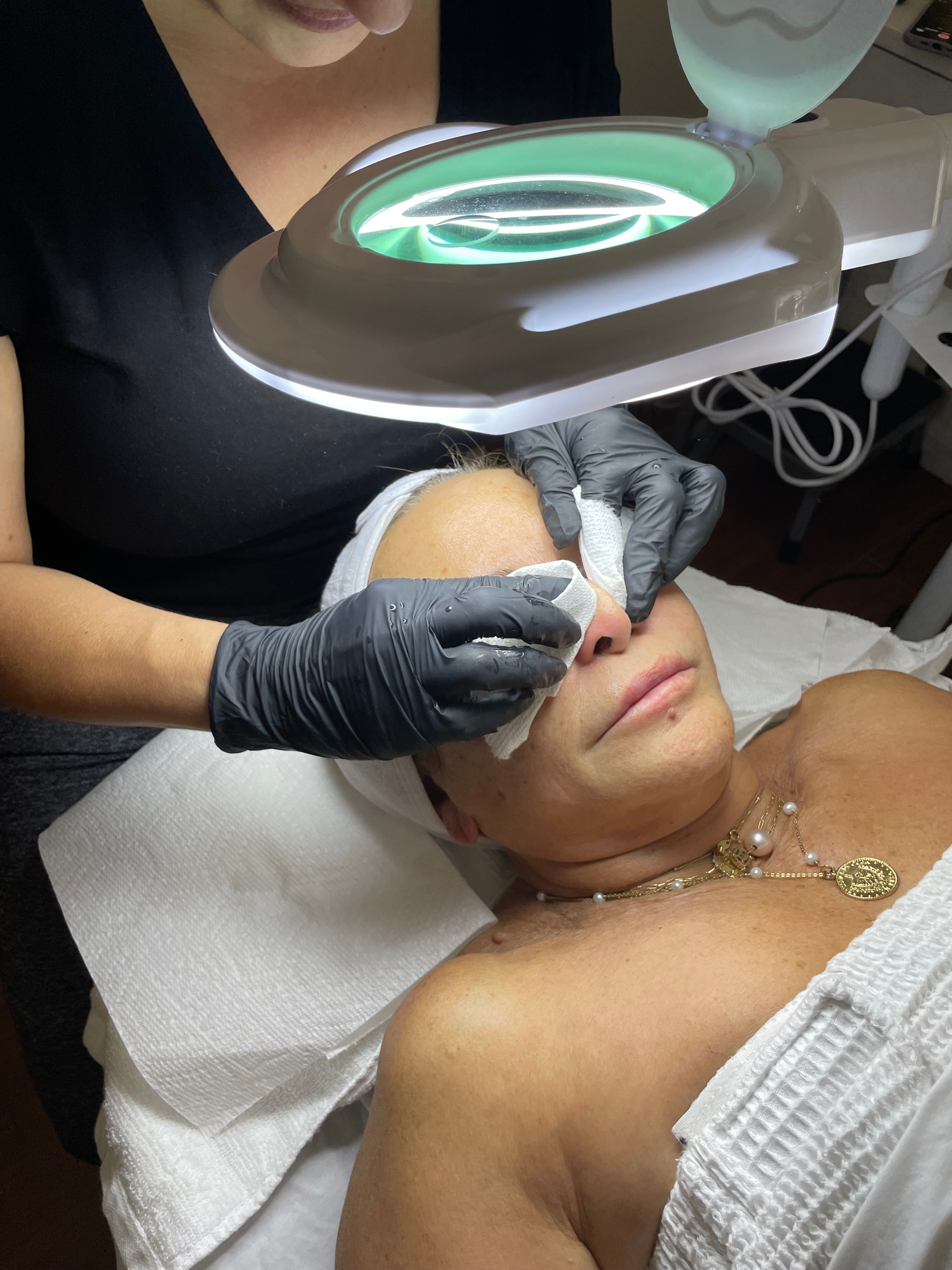 Acne Facial