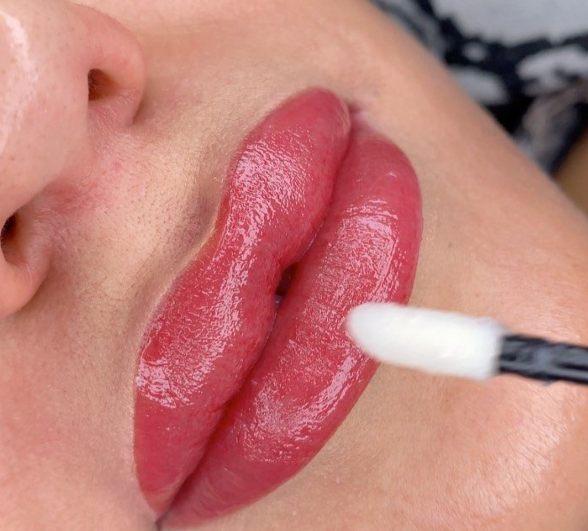 Lips Neutralization
