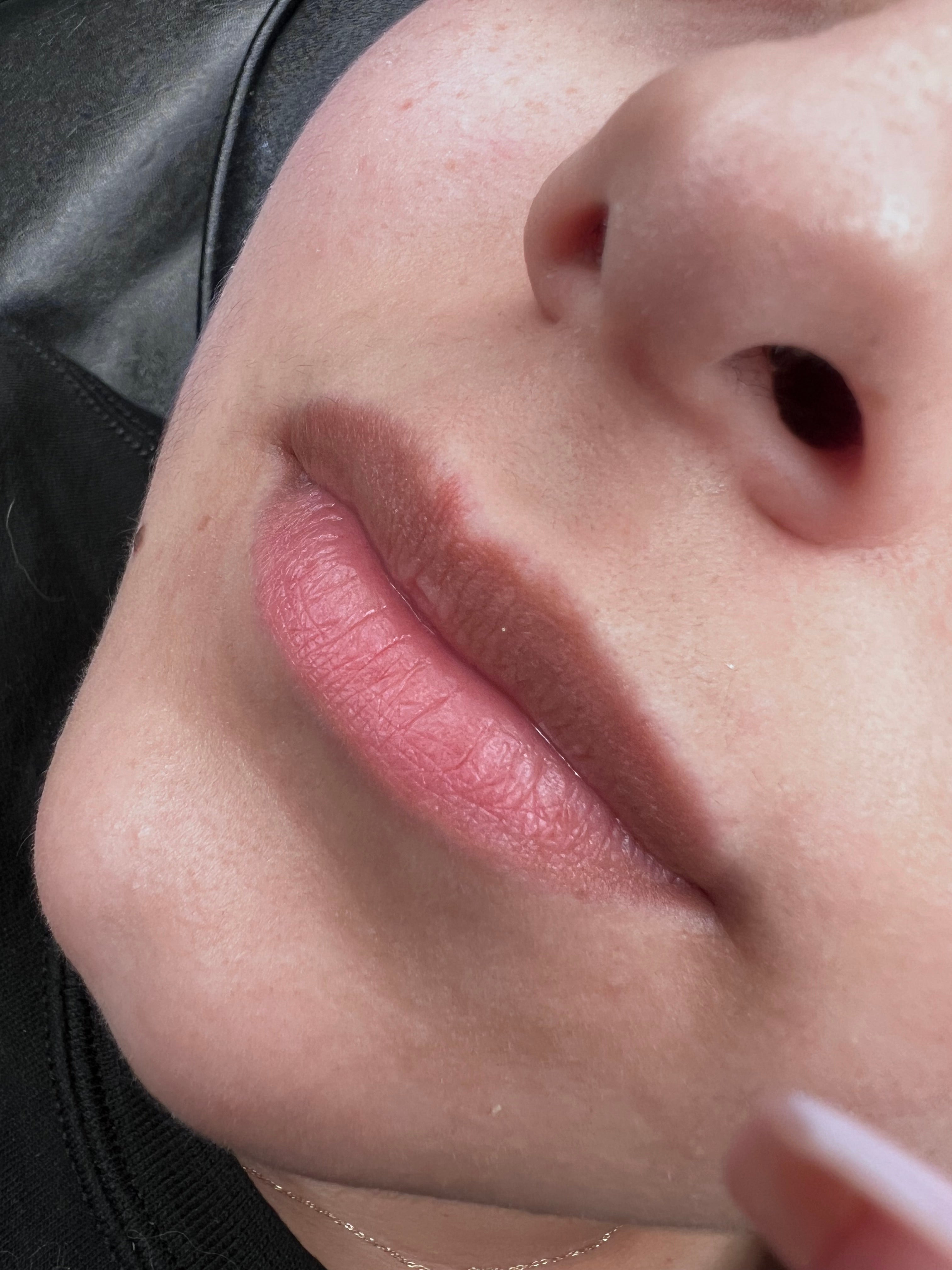 Lips Neutralization