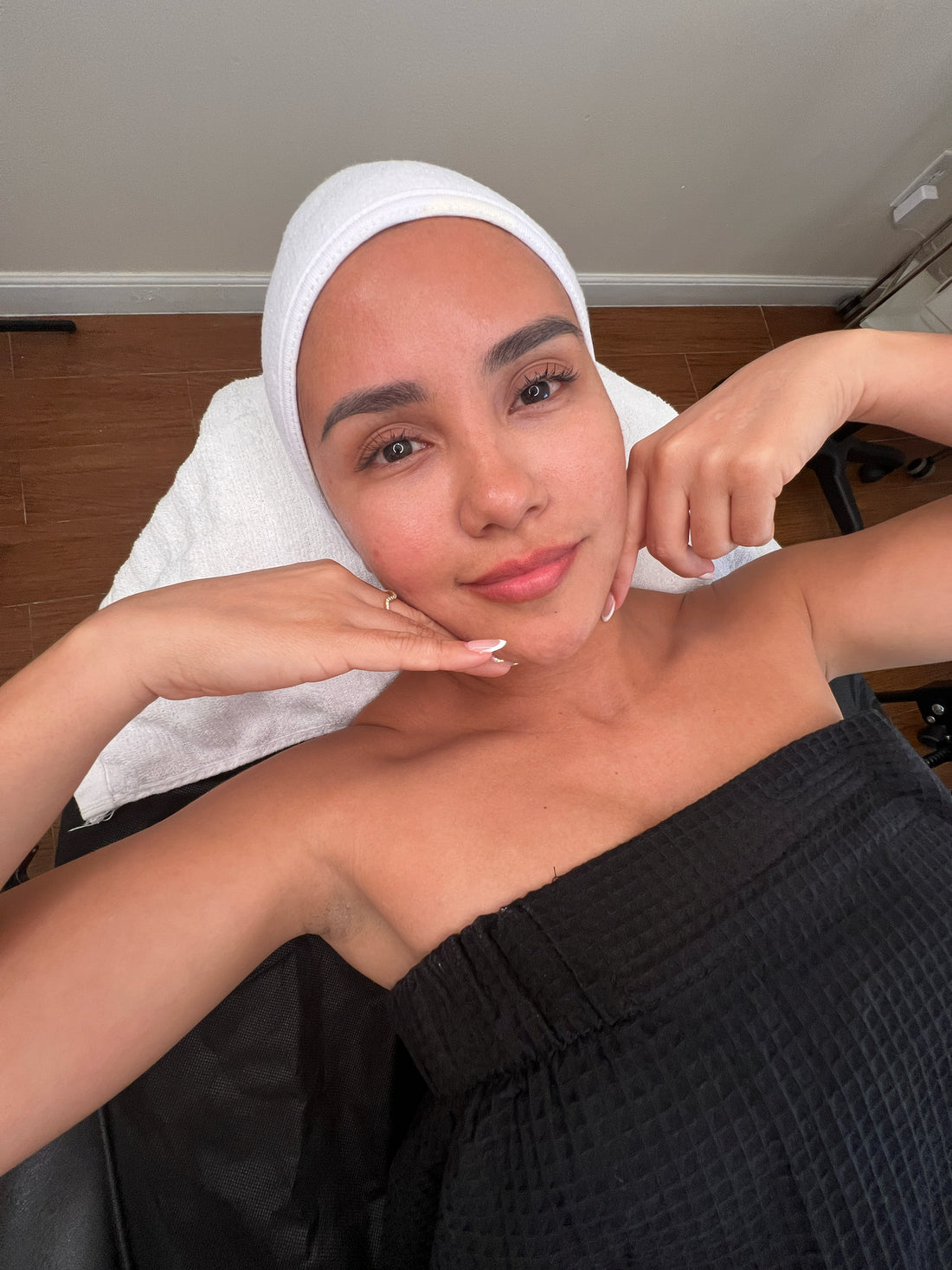Microneedling