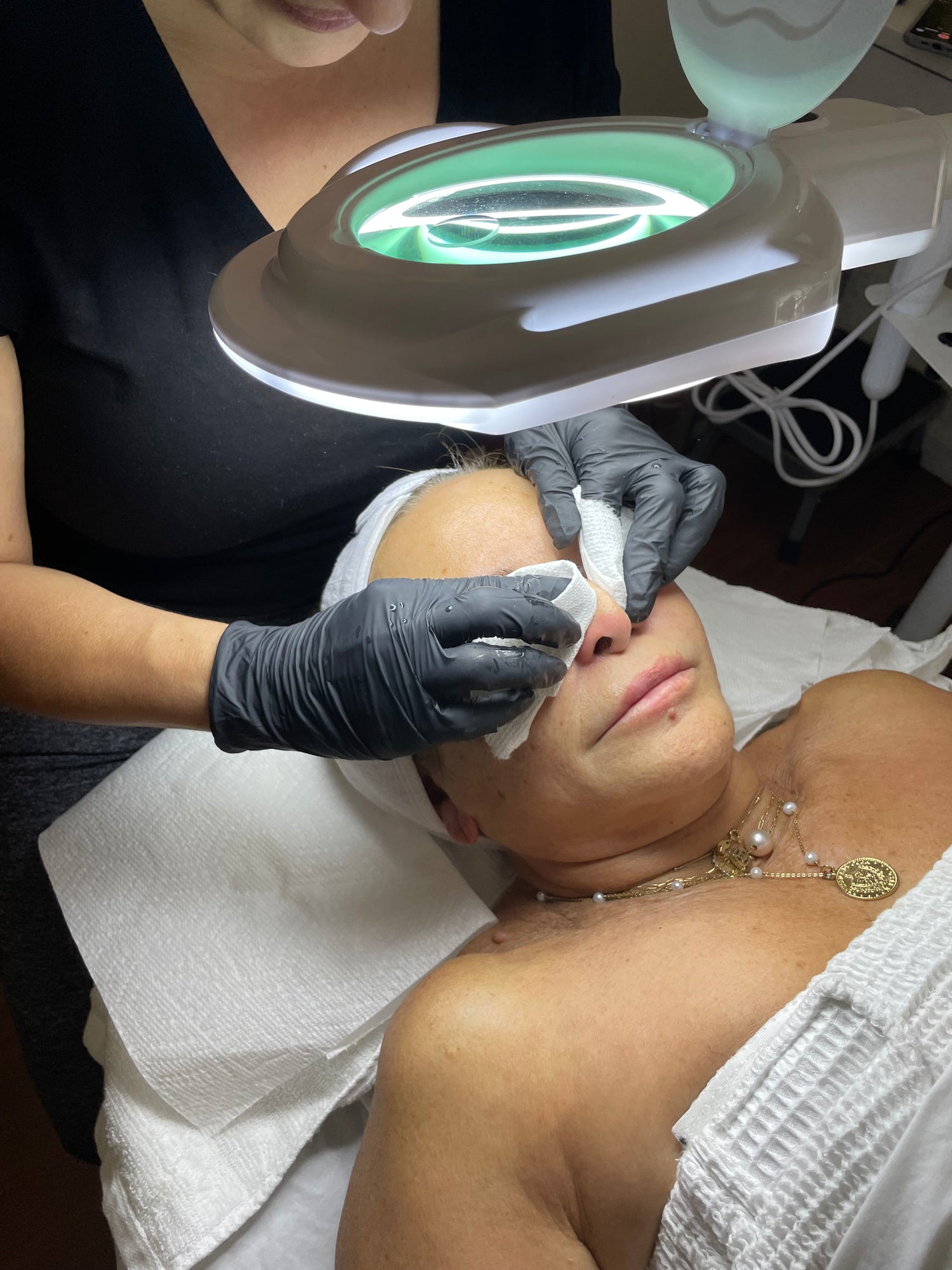 Acne Facial